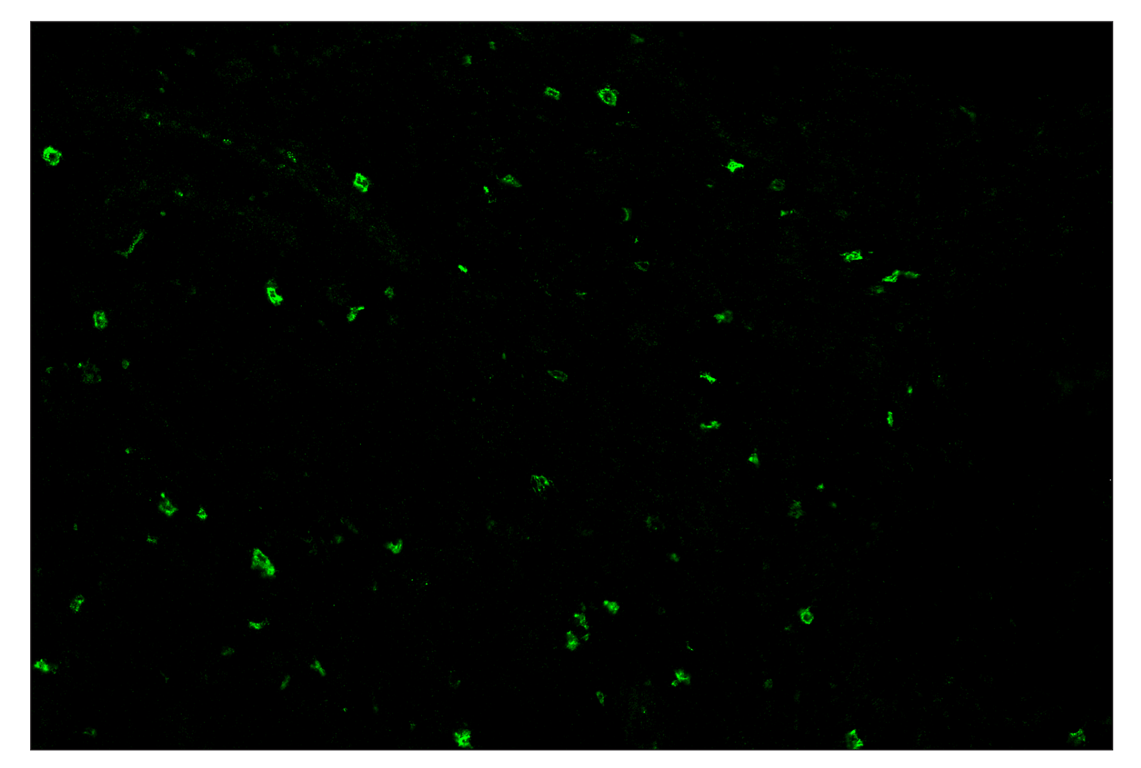 Immunohistochemistry Image 2: XCR1 (D2F8T) & CO-0015-594 SignalStar<sup>™</sup> Oligo-Antibody Pair