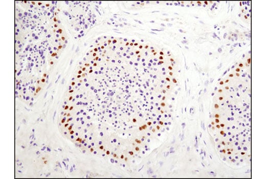 Immunohistochemistry Image 3: DAX1 (D2F1) Rabbit mAb