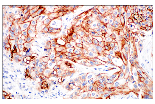 Immunohistochemistry Image 1: Integrin β6 (E4M9P) XP<sup>®</sup> Rabbit mAb