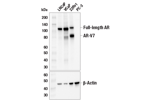 Western Blotting Image 2: Androgen Receptor (D6F11) XP<sup>®</sup> Rabbit mAb (Biotinylated)