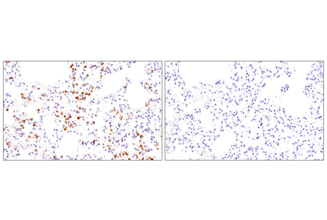 Immunohistochemistry Image 7: CD62L/L-Selectin (E7L2M) Rabbit mAb