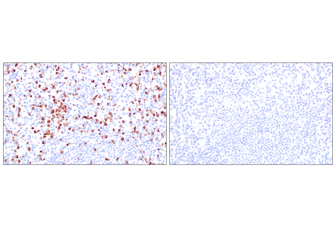 Immunohistochemistry Image 10: NKG7 (F4V5I) Rabbit mAb (BSA and Azide Free)