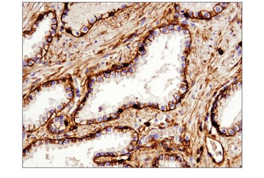 Immunohistochemistry Image 3: CD44 (E7K2Y) XP<sup>®</sup> Rabbit mAb