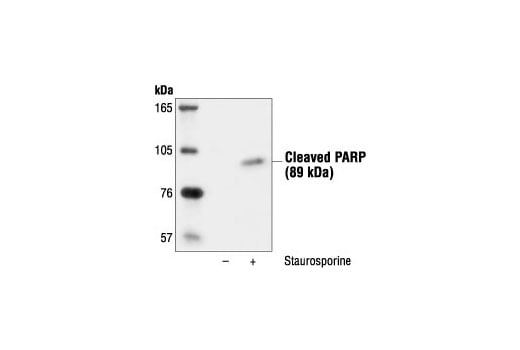 Western Blotting Image 1: Cleaved PARP (Asp214) Antibody