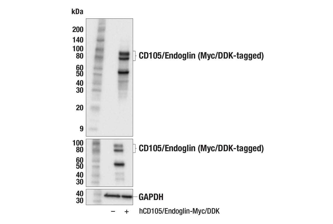 Western Blotting Image 1: CD105/Endoglin (F9C5Q) Rabbit mAb