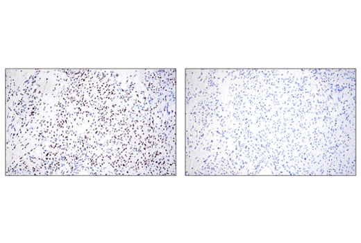 undefined Image 63: Epithelial-Mesenchymal Transition (EMT) IF Antibody Sampler Kit