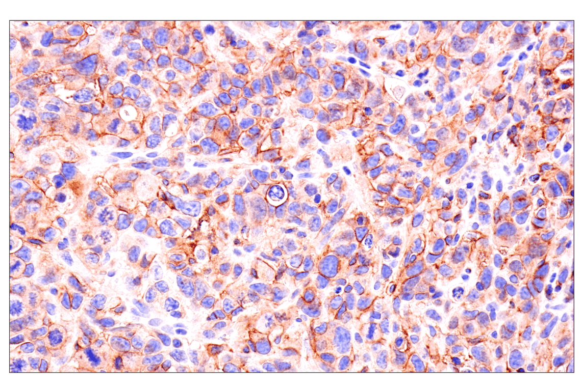 Immunohistochemistry Image 2: Axl (E3Z2H) Rabbit mAb (BSA and Azide Free)