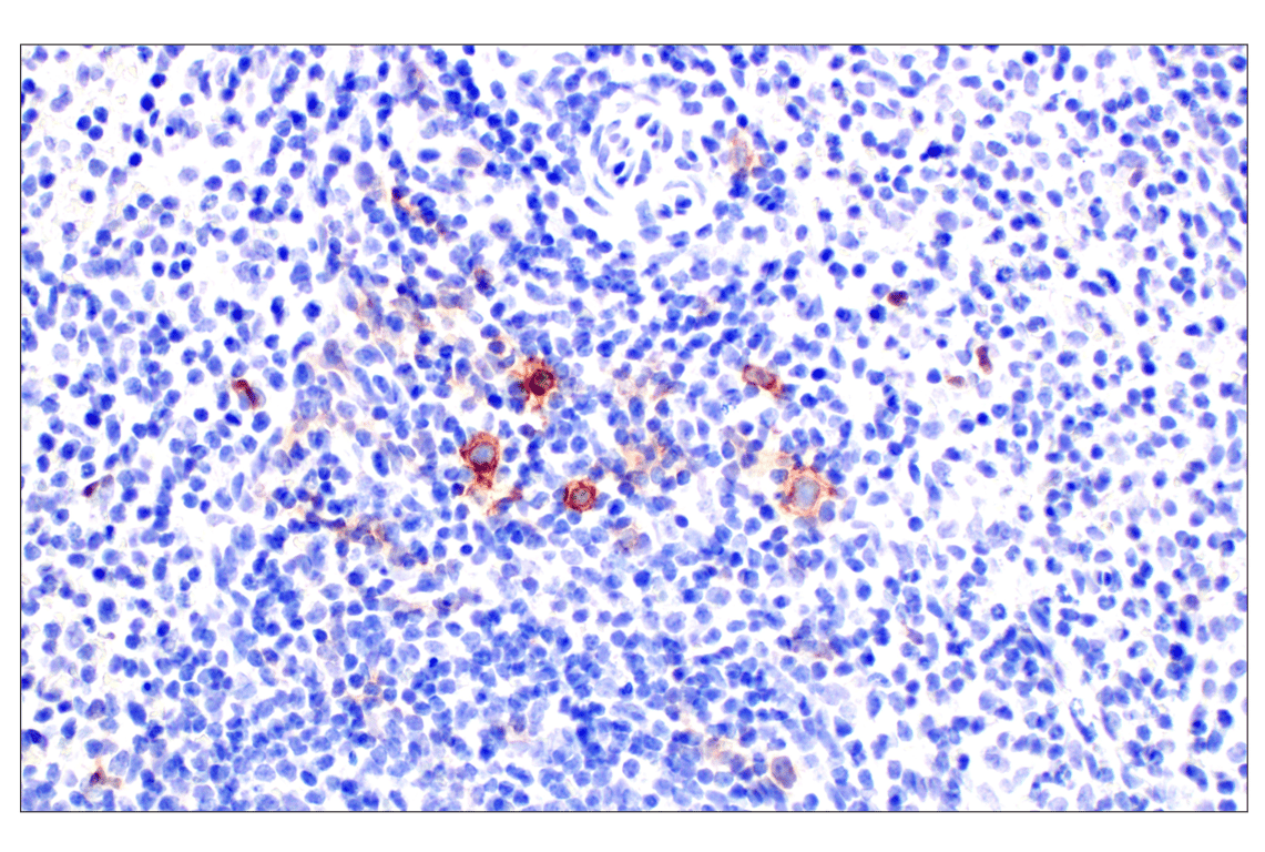 Immunohistochemistry Image 5: TNFRSF8/CD30 (E4L4I) XP<sup>®</sup> Rabbit mAb