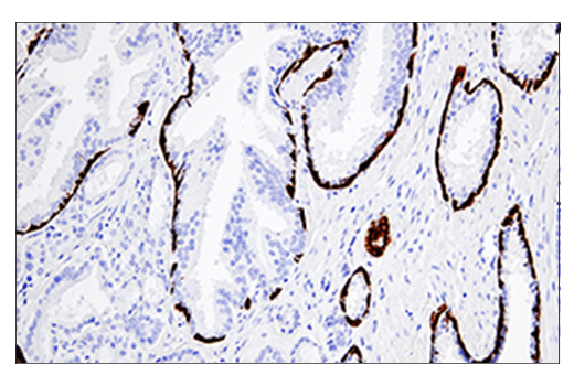 Immunohistochemistry Image 1: Keratin 5 (E2T4B) XP<sup>®</sup> Rabbit mAb