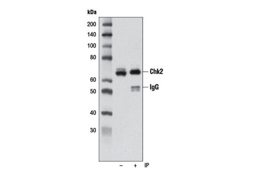 undefined Image 11: PhosphoPlus<sup>®</sup> Chk2 (Thr68) Antibody Duet