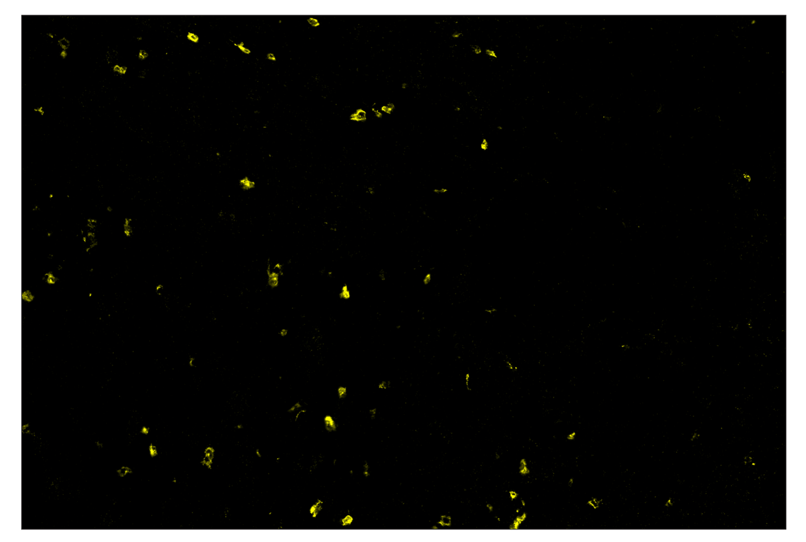 Immunohistochemistry Image 3: XCR1 (D2F8T) & CO-0015-594 SignalStar<sup>™</sup> Oligo-Antibody Pair