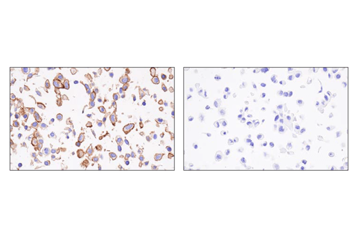 Immunohistochemistry Image 5: CD200 (E5I9V) XP<sup>®</sup> Rabbit mAb