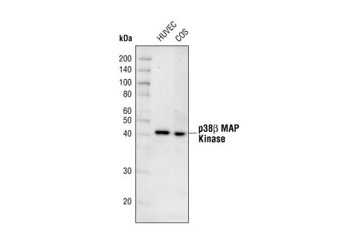 Western Blotting Image 2: p38β MAPK (C28C2) Rabbit mAb