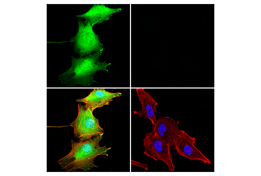 undefined Image 14: Parthanatos Antibody Sampler Kit