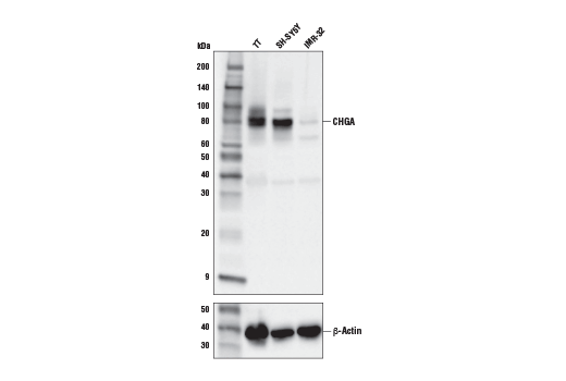 Western Blotting Image 1: CHGA (E8X7R) Rabbit mAb