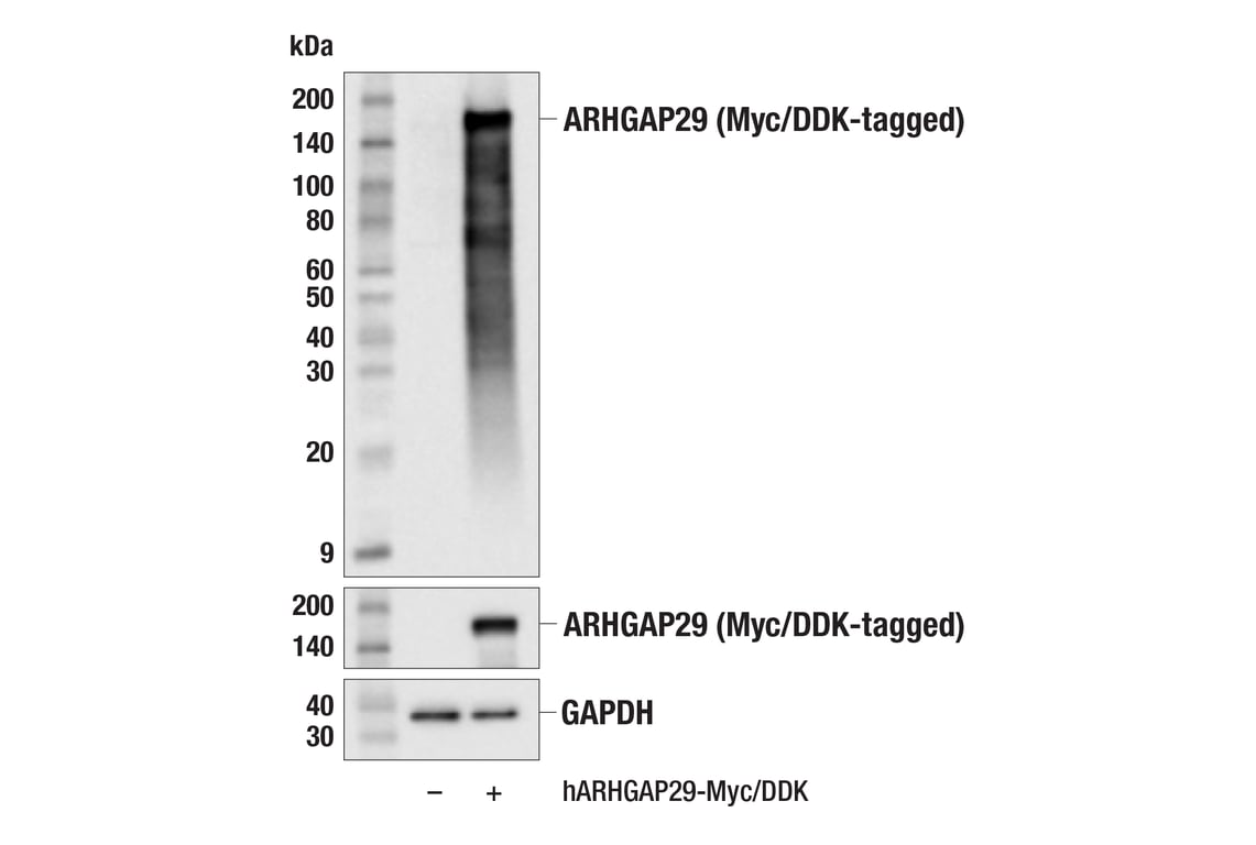 Western Blotting Image 2: ARHGAP29 (F6O5B) Rabbit mAb