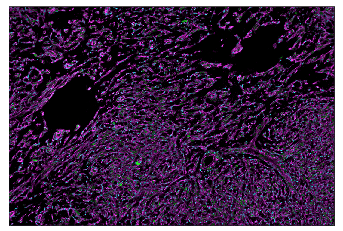 Immunohistochemistry Image 1: OX40L (D6K7R) & CO-0087-594 SignalStar<sup>™</sup> Oligo-Antibody Pair