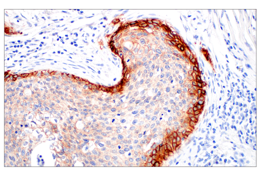 Immunohistochemistry Image 4: Integrin β6 (E4M9P) XP<sup>®</sup> Rabbit mAb
