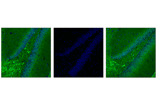 Immunofluorescence Image 1: Phospho-Tau (Thr205) (E7D3E) Rabbit mAb (Alexa Fluor<sup>®</sup> 488 Conjugate)