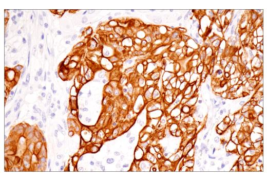 Immunohistochemistry Image 1: Pan-Keratin (5D3/LP34) Mouse mAb