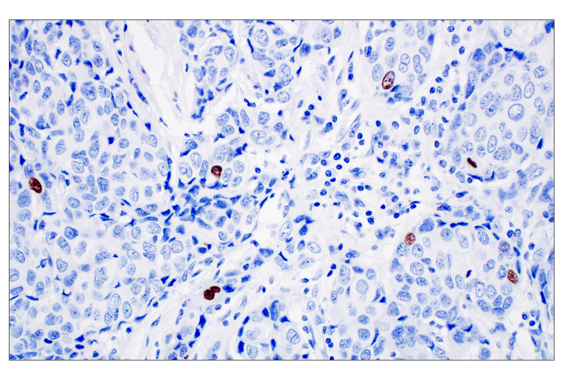 Immunohistochemistry Image 4: Phospho-Histone H3 (Ser10) (D7N8E) XP<sup>®</sup> Rabbit mAb (BSA and Azide Free)