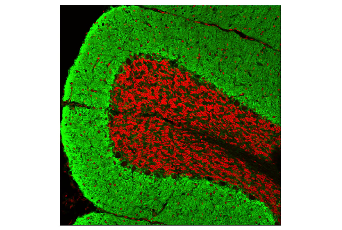 Immunofluorescence Image 1: EAAT1 (D44E2) XP<sup>®</sup> Rabbit mAb (BSA and Azide Free)