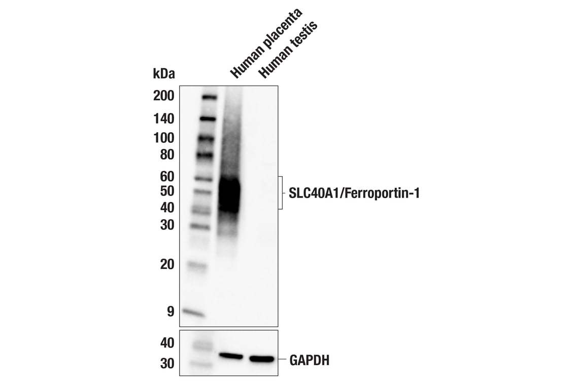 Western Blotting Image 2: SLC40A1/Ferroportin-1 (F4A2M) Rabbit mAb