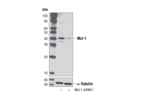 undefined Image 1: SignalSilence<sup>®</sup> Mcl-1 siRNA I