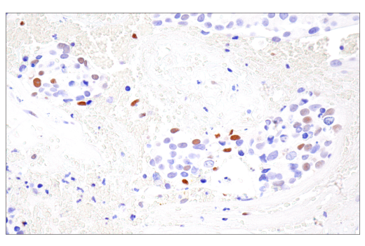 Immunohistochemistry Image 3: HIF-1α (E1V6A) Rabbit mAb