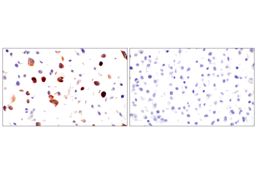 Immunohistochemistry Image 5: SARS-CoV-2 Nucleocapsid Protein (E9L7H) XP<sup>®</sup> Rabbit mAb