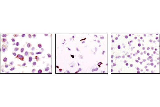 Immunohistochemistry Image 1: Keratin 17/19 (D32D9) XP<sup>®</sup> Rabbit mAb (BSA and Azide Free)
