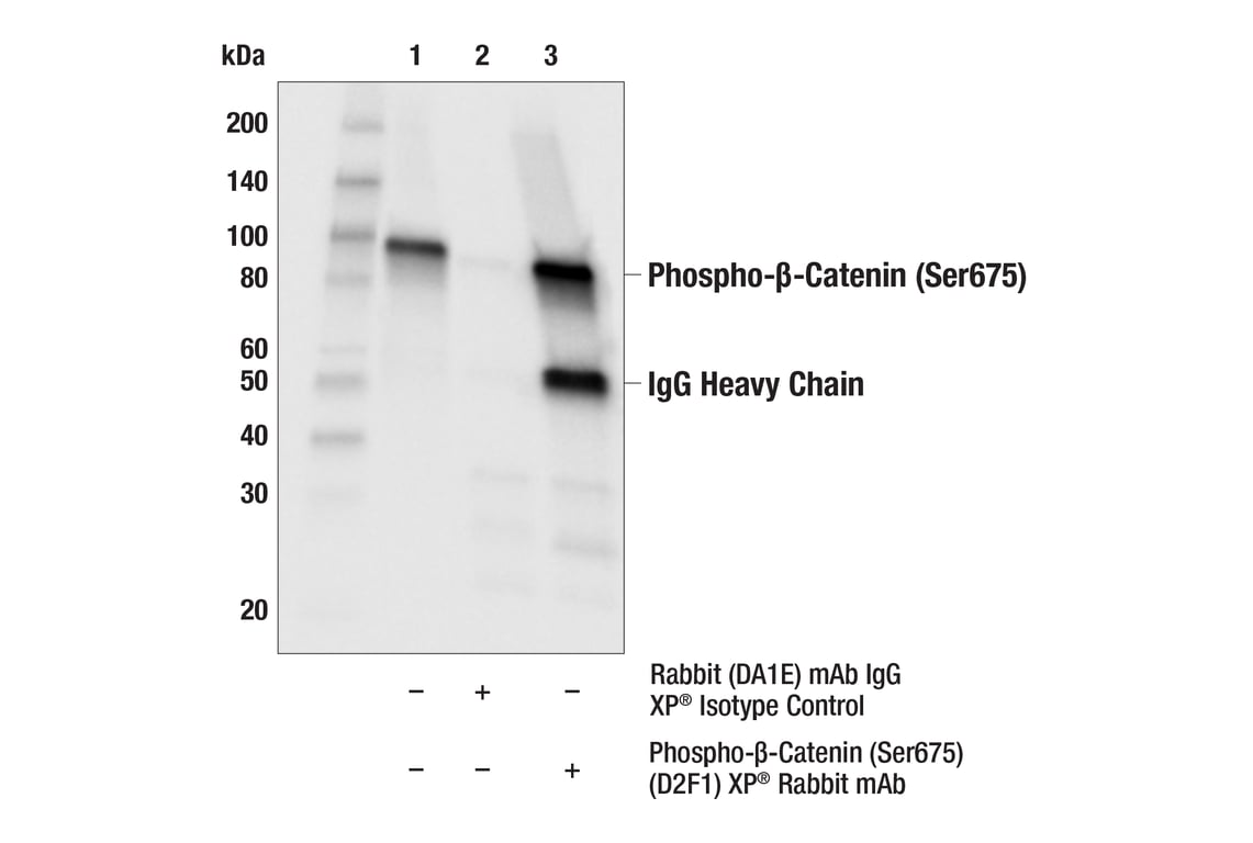 undefined Image 5: PhosphoPlus<sup>®</sup> β-Catenin (Ser675) Antibody Duet