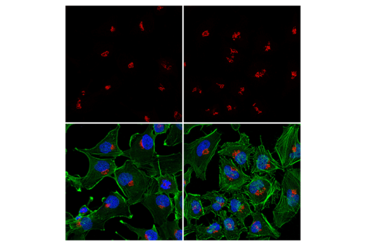 Immunofluorescence Image 1: GM130 (D6B1) XP® Rabbit mAb (Alexa Fluor® 555 Conjugate)