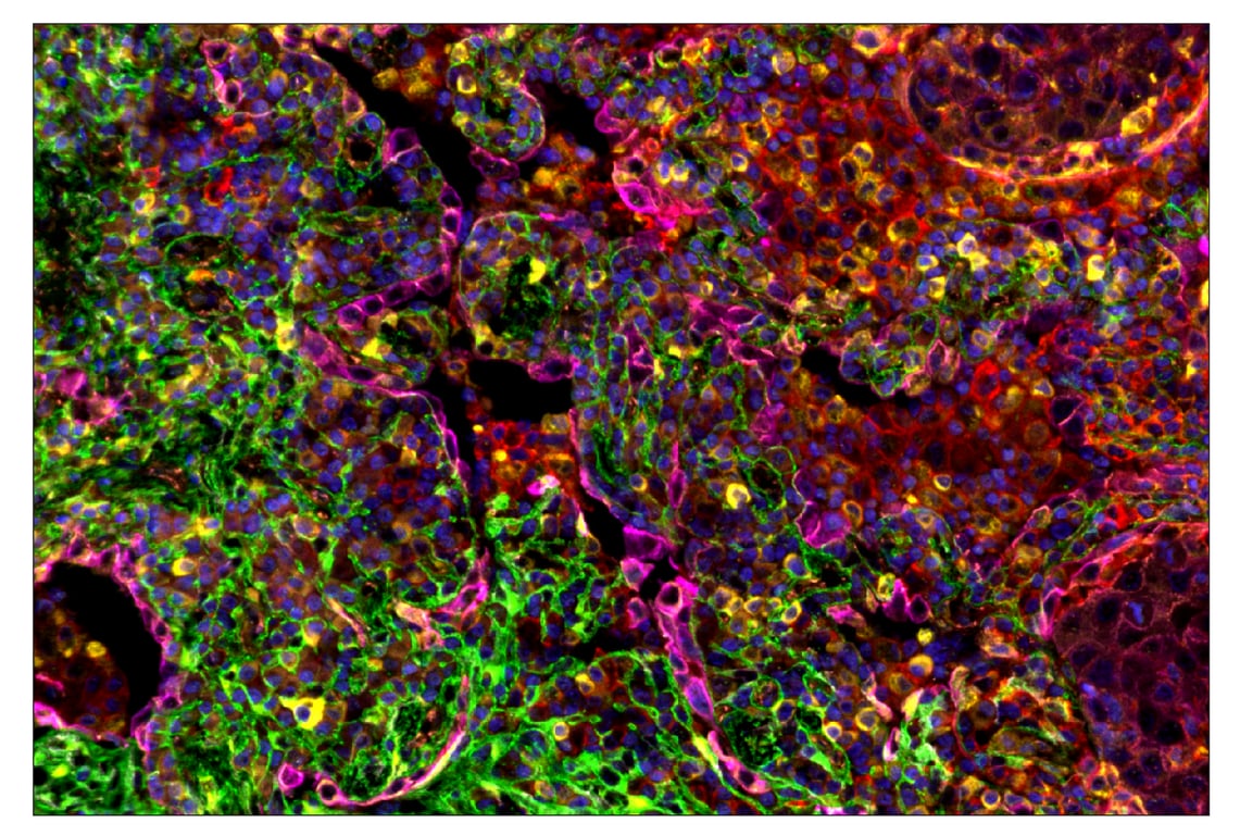 Immunohistochemistry Image 6: CD40 (D8W3N) & CO-0115-647 SignalStar<sup>™</sup> Oligo-Antibody Pair