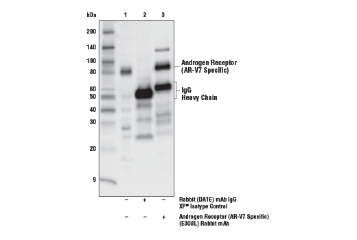 undefined Image 7: Androgen Receptor Antibody Sampler Kit