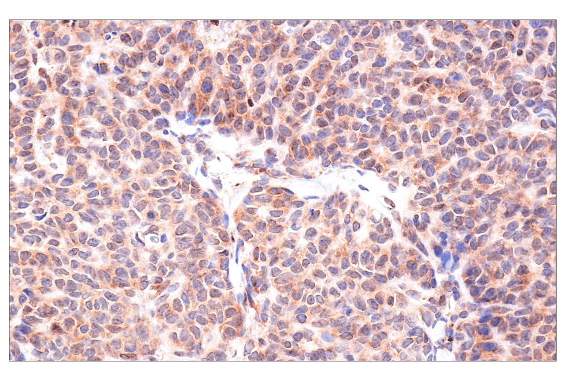 Immunohistochemistry Image 5: ADAR1 p150 Isoform (E6U1U) Rabbit mAb