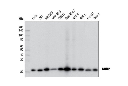 Western Blotting Image 1: SOD2 (D3X8F) XP® Rabbit mAb