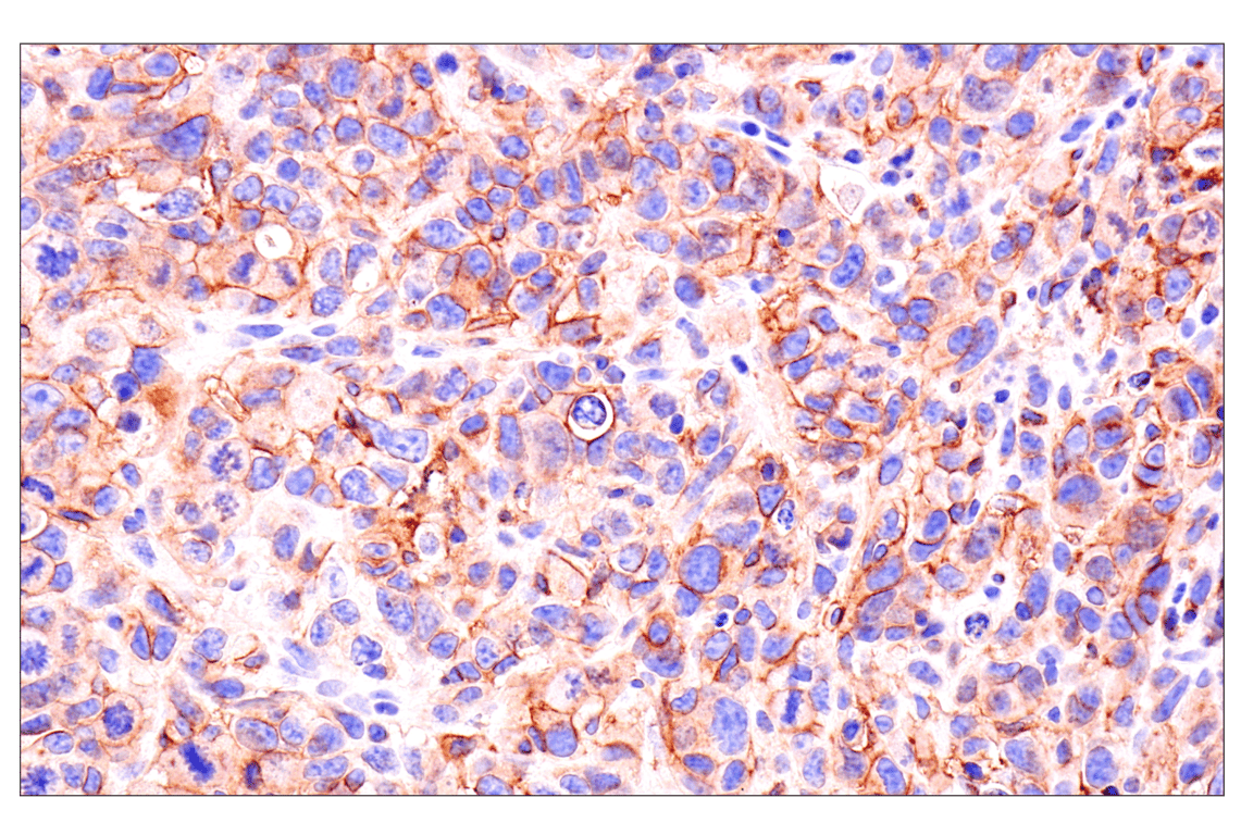 Immunohistochemistry Image 2: Axl (E3Z2H) Rabbit mAb