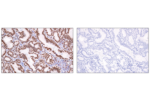 Immunohistochemistry Image 3: ADAR1 (E6X9R) XP<sup>®</sup> Rabbit mAb