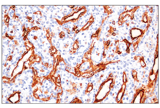 Immunohistochemistry Image 2: CD141/Thrombomodulin (E7Y9P) XP<sup>®</sup> Rabbit mAb (BSA and Azide Free)