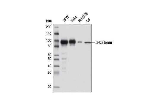 undefined Image 21: Cadherin-Catenin Antibody Sampler Kit