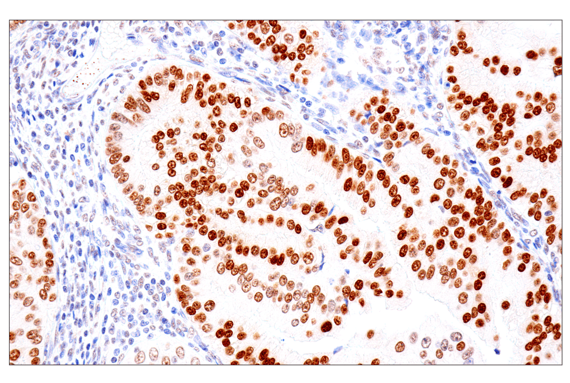 Immunohistochemistry Image 3: FoxA1/HNF3α (IHC578) Mouse mAb