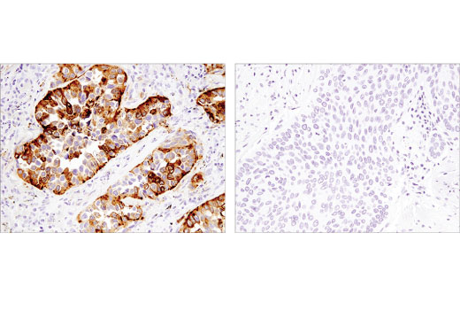 Immunohistochemistry Image 1: Napsin A (D5P6G) XP<sup>®</sup> Rabbit mAb