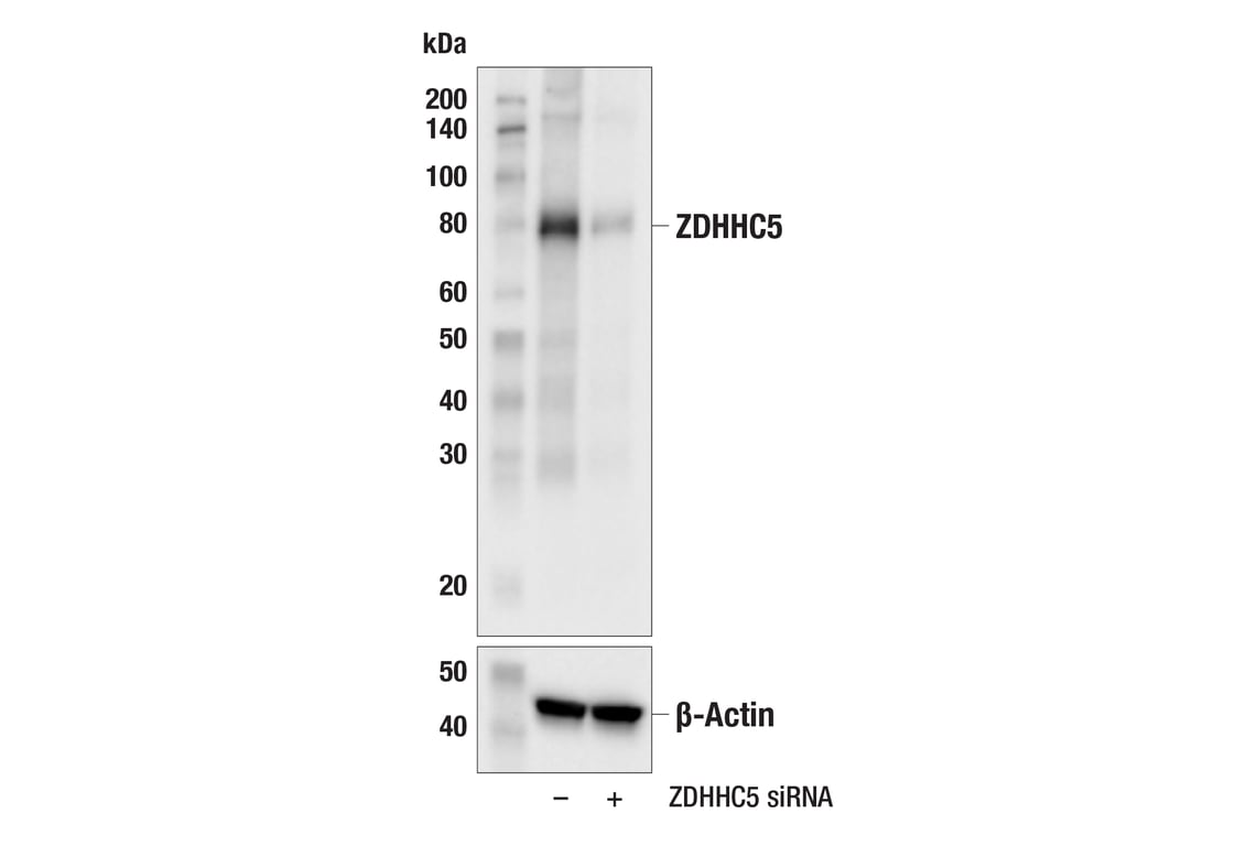 Western Blotting Image 2: ZDHHC5 (E7T4N) Rabbit mAb