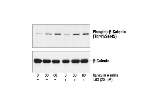 undefined Image 9: β-Catenin Antibody Sampler Kit
