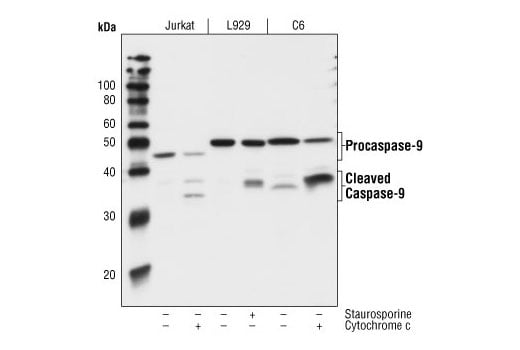 undefined Image 6: Apoptosis Antibody Sampler Kit II