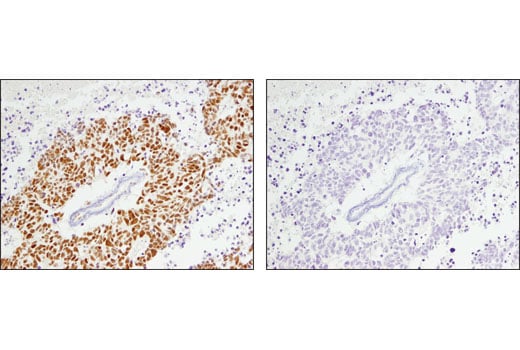 undefined Image 40: BAF Complex IHC Antibody Sampler Kit