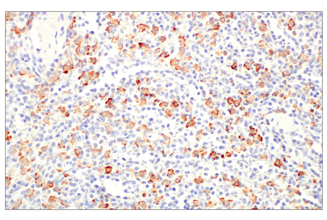 Immunohistochemistry Image 5: CD163 (D6U1J) Rabbit mAb