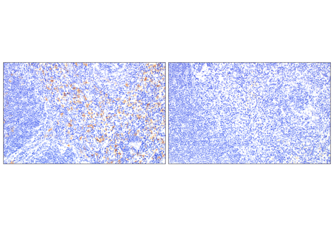 Immunohistochemistry Image 6: C1QB (E3U6X) Rabbit mAb (BSA and Azide Free)