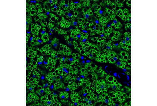 Immunofluorescence Image 1: Perilipin-1 (D1D8) XP<sup>®</sup> Rabbit mAb